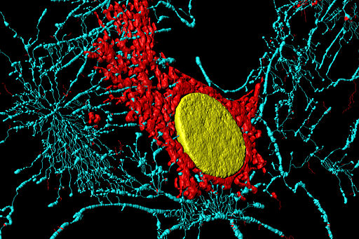 512px-Fibroblast_(BPAE)